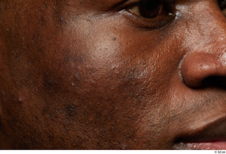 HD Face Skin Clayton Bradford cheek face nose skin pores…